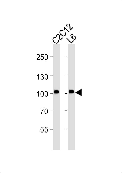 Musk Antibody Purified Mouse Monoclonal Antibody Mab WB IHC P E