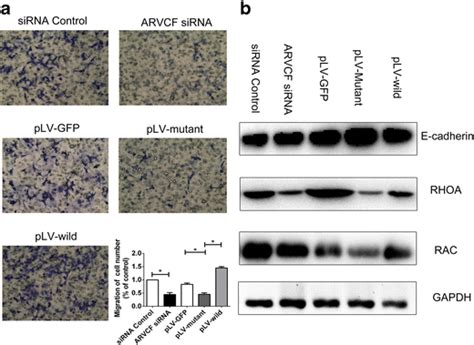 Mutated Arvcf Suppressed Cell Migration By Regulating Rhoa And Rac A