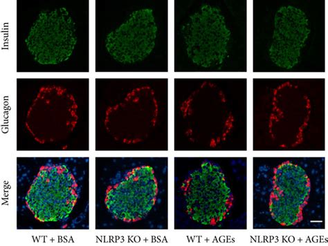 Nlrp3 Knockout Improves The Abnormal Response To Glucose In Mice