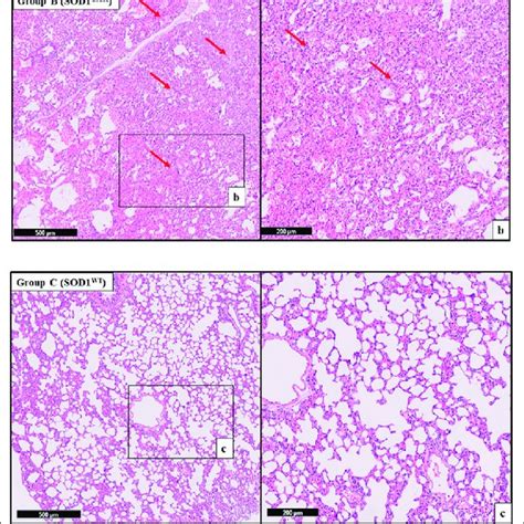 H E Stained Lung Tissue Sections Of Lung Tissues Representative