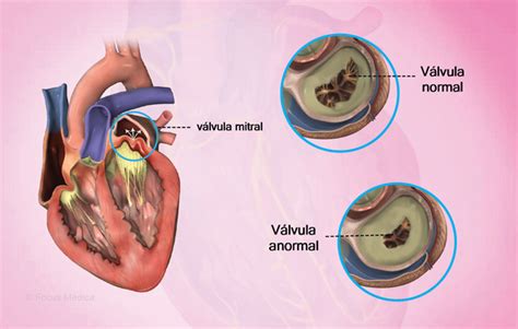 Health Condition Symptoms Causes Treatment And More