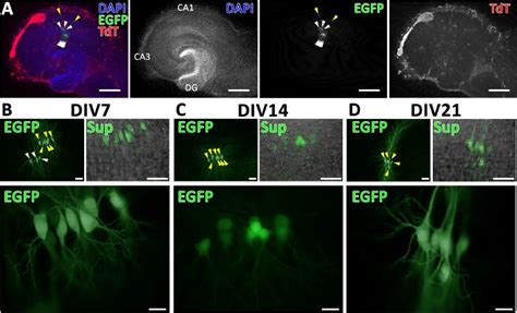 Single Cell Electroporation In Organotypic Brain Slice Cultures An In