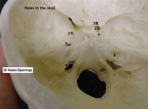 Holes Of Skull 3 Diagram Quizlet