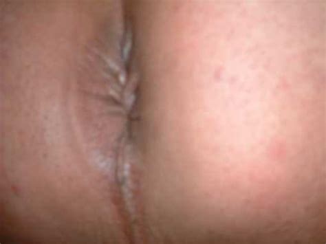 Luciano Fagot The Ass Pics XHamster