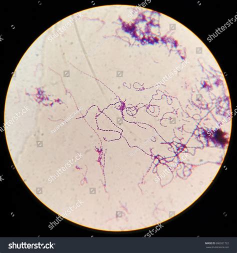 Strep Throat Bacteria Under Microscope