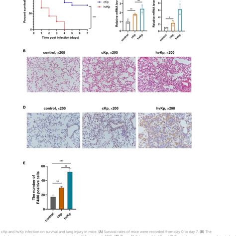 Effects Of CKp And HvKp Infection On The Production Of Pro Inflammatory