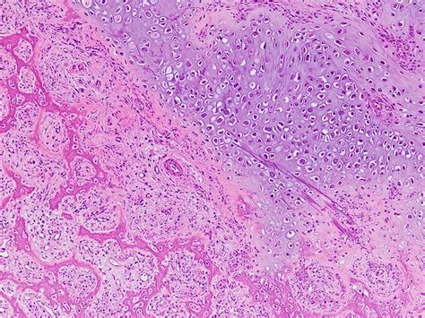 30 Bone Histology Diagram Saimajordan