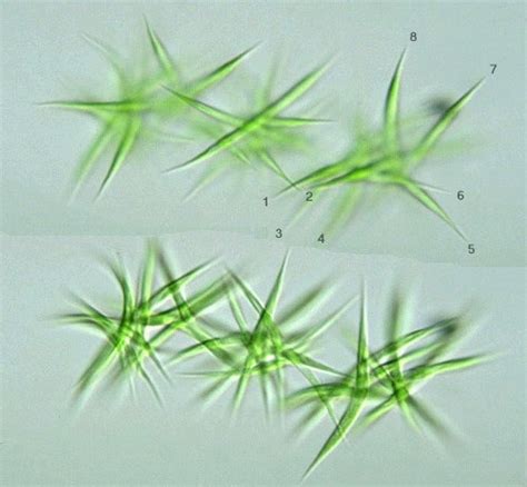 Protist Images: Ankistrodesmus falcatus