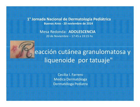 PDF Reacción cutánea granulomatosa liquenoide por tatuaje Las