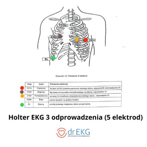 Rozmieszczenie Elektrod Odprowadzenia Elektrod Holter Ekg Model