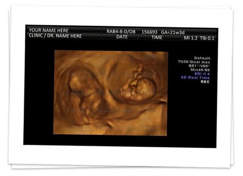 3d Ultrasound 6-8 Weeks Twins - Fake Ultrasound