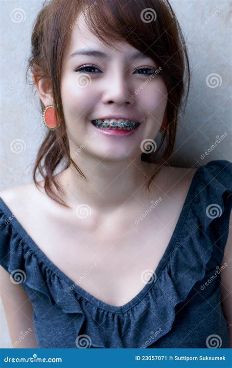 Asian Braces Girl Smile Stock Image Image Of Asian Chinese 23057071