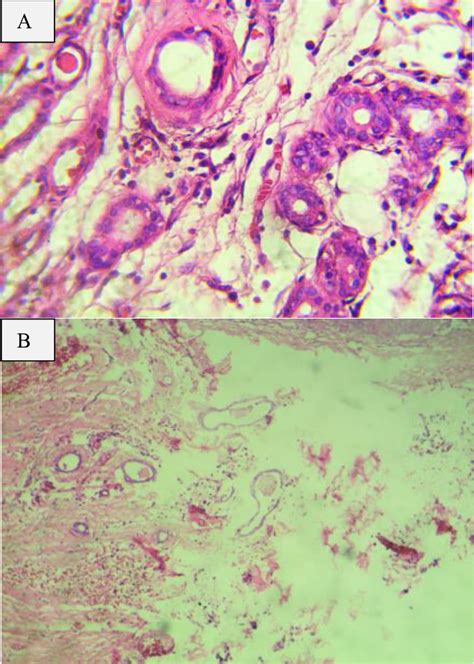 Photomicrograph Of The Lesion Download Scientific Diagram