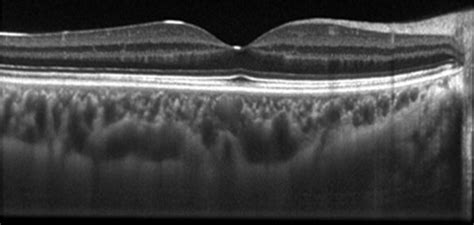 Macula and Retina department Βλέμμα