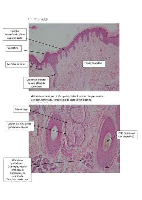 Tejido Epitelial Glandular Julieta Udocz