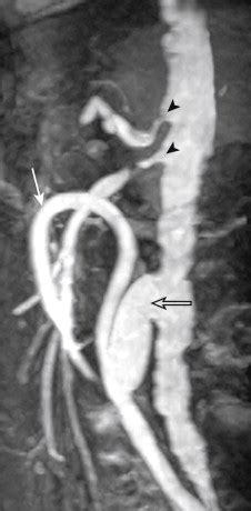 Visceral Arteries Clinical Tree