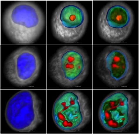 Three Dimensional Imaging Of Cancer Cells Arizona Cancer Evolution Center