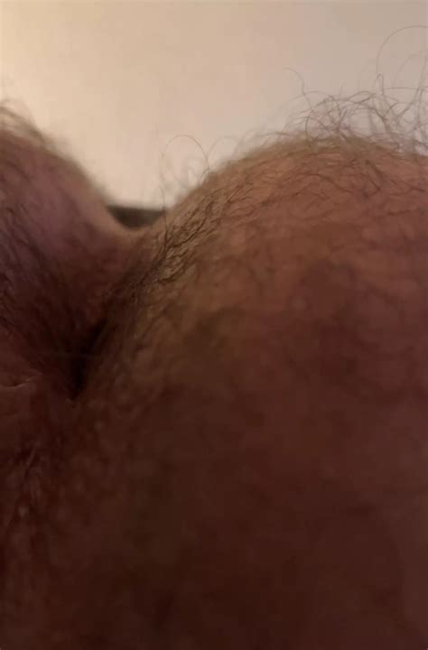 My Fuzzy Peach Nudes Hairymanass Nude Pics Org