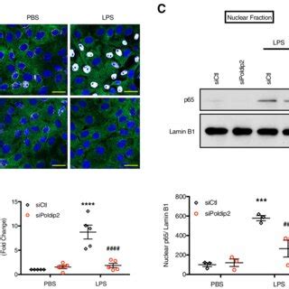 Sirna Against Poldip Blocks Lps Induced P Nuclear Translocation