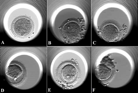 Frontiers Oocyte Degeneration After Icsi Is Not An Indicator Of Live