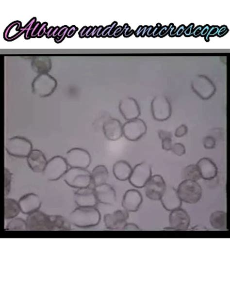 Albugo Under Microscope Fungi Cutie Girl 0023 Youtube