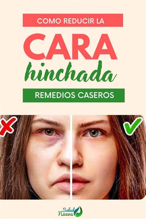 Cómo reducir la hinchazón en la cara