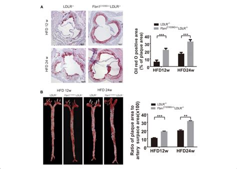 Pathological Staining Of The Aorta And Aortic Sinus Of Fbn1 C1039g − Download Scientific