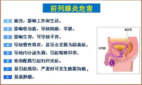 前列腺炎怎么调理治愈前列腺炎症状及如何根治法道营养草本网站