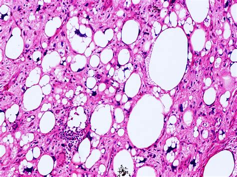 Pathology Links Pathology Resident Wiki