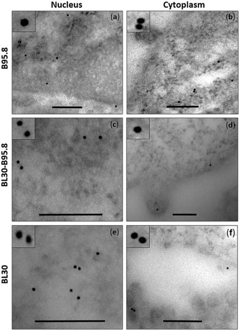 Tracking Ebv Encoded Rnas Ebers From The Nucleus To The Excreted Exosomes Of B Lymphocytes