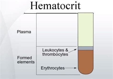 Hematocrit Levels Chart A Visual Reference Of Charts Chart Master