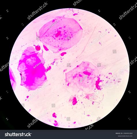 High Vaginal Swab Hvs Gram Stained Stock Photo Shutterstock