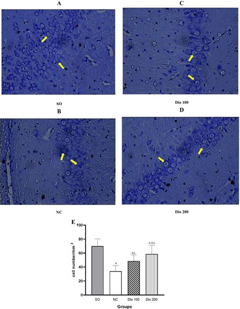 Histopathological Examination Of CA1 Region Of Hippocampus Stained With