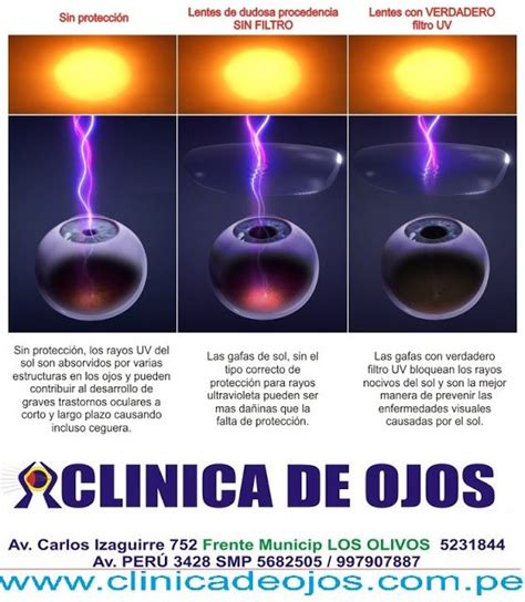 Clínica de Ojos Oftalmic Láser FILTRO UV