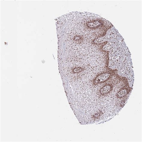 Tissue Expression Of H3c15 Staining In Vagina The Human Protein Atlas