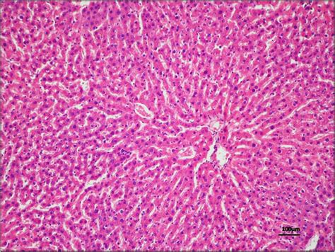 Morphological And Histological Analysis Of A Liver Samplehaematoxylin Download Scientific