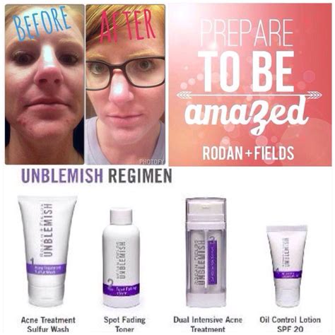 Rodan and Fields Unblemish acne skin care products | Acne oil, Skin ...