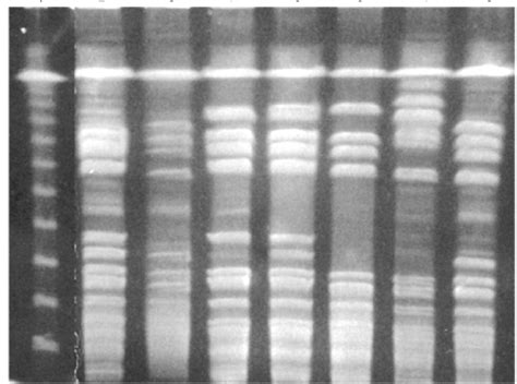 Pulsed Field Gel Electrophoresis Profiles Of Genomic Dna From