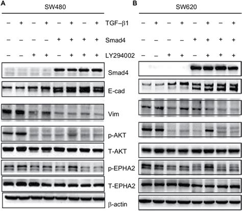 Smad4 Reexpression Modulates E Cad And Vim Expression By Akt Epha2