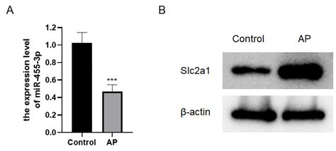 Mir P Ameliorates Pancreatic Acinar Cell Injury By Targeting