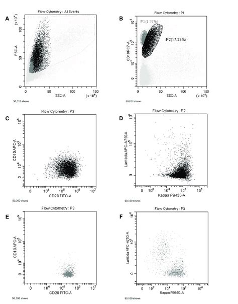 Flow Cytometric Analysis Of An Ecoendoscopic Lymph Node Biopsy A Download Scientific