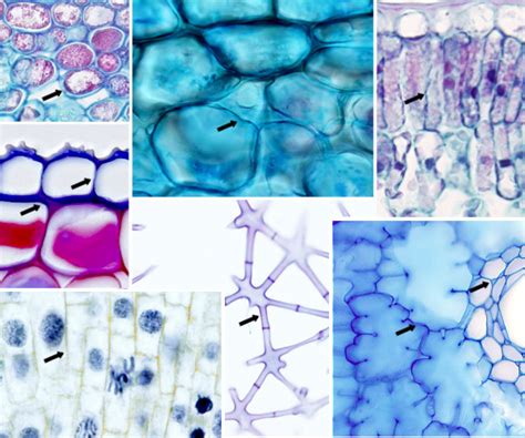 La célula. Ampliaciones. Pared celular. Atlas de Histología Vegetal y Animal