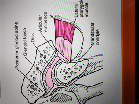 Ch 14 Radiology Of TMJ Flashcards Quizlet