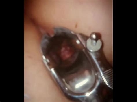 Rectal Wall Injection XVIDEOS