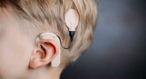 Implantes cocleares para todos los que los necesiten | Somos Pacientes