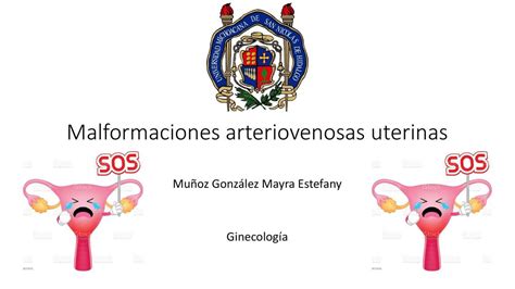 Malformaciones Arteriovenosas Uterinas Res Menes Medicina Udocz