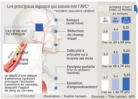 Accident Vasculaire C R Bral Avc Qu Est Ce Que C Est Fiches