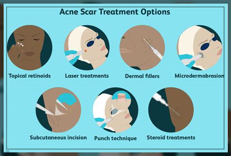 Acne Scars Removal- Effective Methods - Dentist Ahmed : Official Website