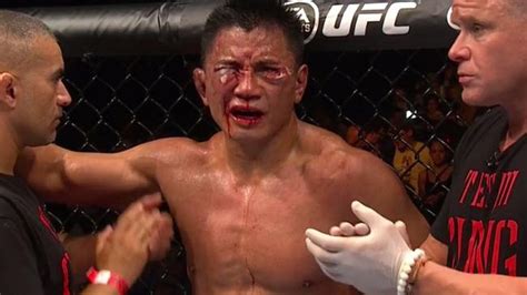 Cung Le suffers gruesome eye injury against Michael Bisping during UFC ...