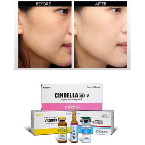 Korea Original Glutathione Set Luthione Cindella Ascorbic Acid Vitamin